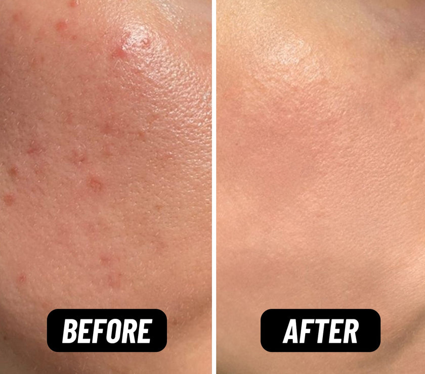 Bring Your Fire Facial Oil