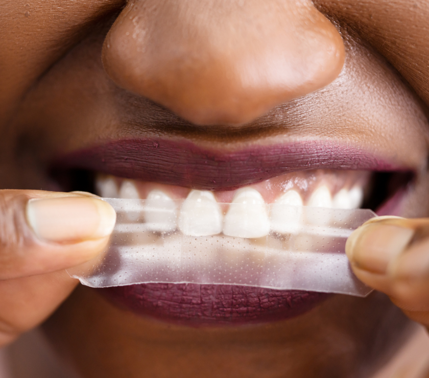 All Rounder Whitening Set - PAP-X™ Advanced Teeth Whitening Strips & Pen