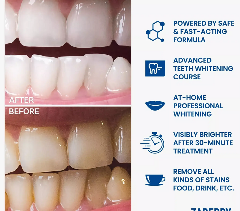 Advanced Teeth Whitening Ultimate Kit